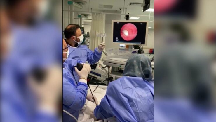 Hastanın akciğerine kaçan sarımsak operasyonla çıkarıldı