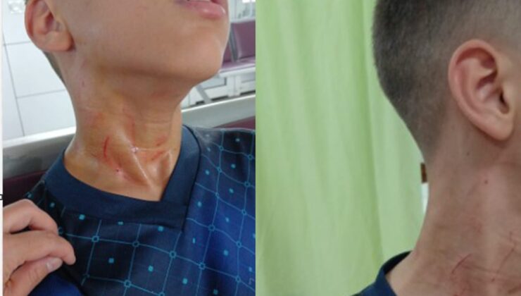 Konya’daki ortaokulda öğretmenden öğrenciye darp iddiası: "Seni öldürürüm"