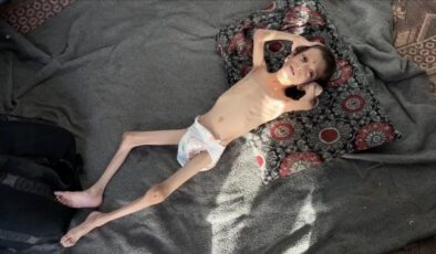 10 yaşındaki Gazzeli Nafız 4 aylık bebeğe dönüştü: Annesi taşımaya bile korkuyor