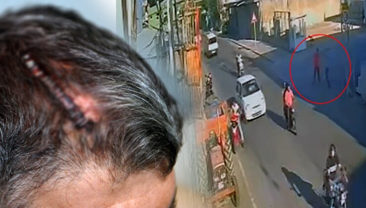 Miras için beyzbol sopasıyla dövüldü: Mahkemenin kararı ile  ikinci şoku yaşadı