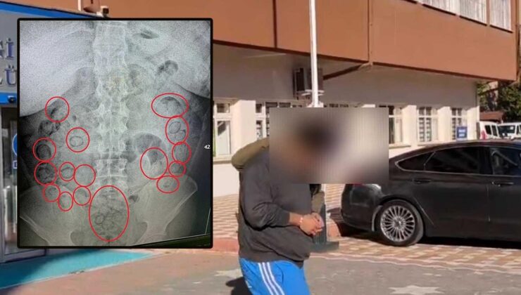 Skandal röntgende ortaya çıktı! 400 gram uyuşturucu bakın neresinden çıktı
