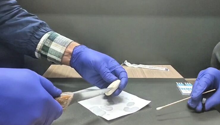 Taksiden indirilen yabancının mide ve bağırsağından uyuşturucu çıktı