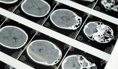 Uzmanlardan masajla gelen inme uyarısı