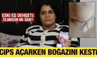 Cips paketini açarken boğazını kesti! Ayrıldığı eşi dehşeti yaşattı: Ölmedin mi sen?