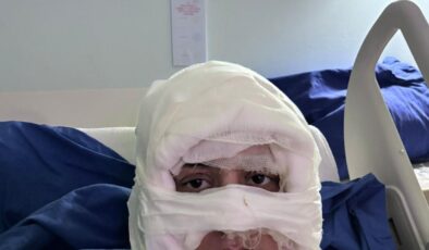 Kadıköy’de akıl almaz olay: Genç kadın başka bir kadın tarafından ateşe verildi