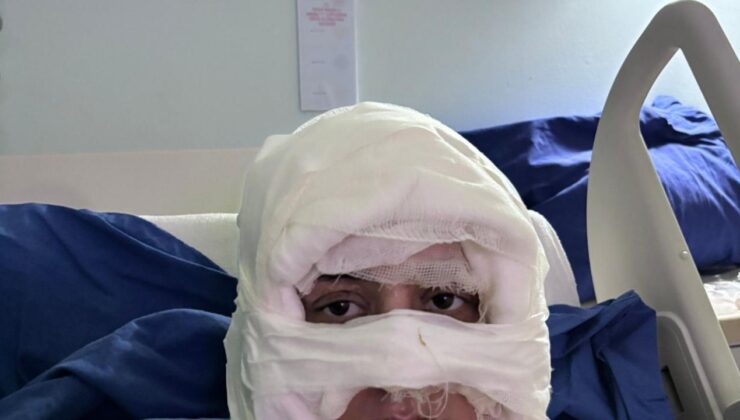 Kadıköy’de akıl almaz olay: Genç kadın başka bir kadın tarafından ateşe verildi