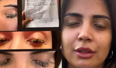 Kirpik yaptırmak isteyen kadının hayatı kabusa döndü: Kör olacaktı!