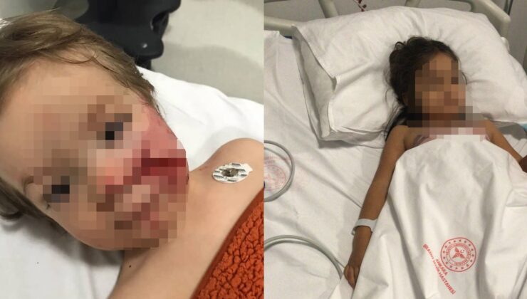 Pitbull dehşeti: 2 kardeş hastanelik oldu