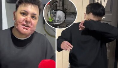 65 ameliyat geçirdi, 12 gün uyutuldu! Hayatı saniyeler içinde kabusa döndü