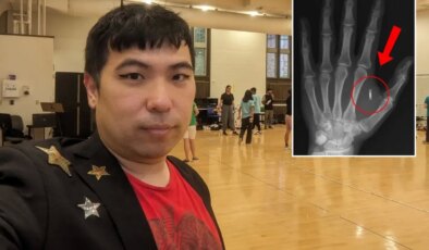 Akılalmaz hata! Eline yerleştirdiği mikroçipin şifresini unuttu