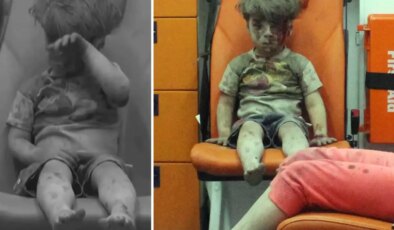 Bakın nerede ortaya çıktı: İşte dünya gündemine oturan Ümran bebeğin son hali