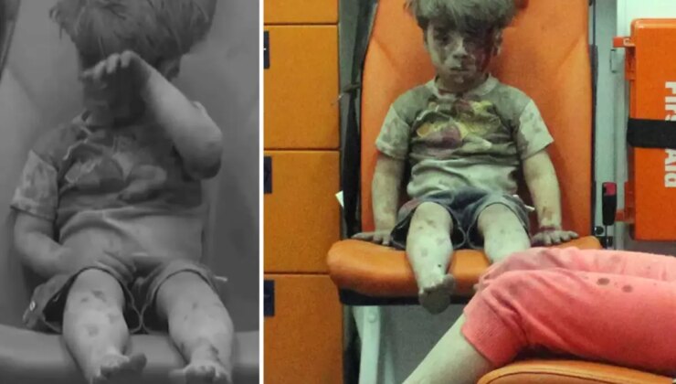 Bakın nerede ortaya çıktı: İşte dünya gündemine oturan Ümran bebeğin son hali