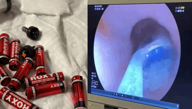 Cezaevinde korkunç olay: 9 pil, 3 jilet yuttu!