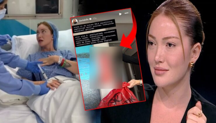 Danla Bilic vücudundan çıkan maddeyi paylaştı: Görenler inanamadı