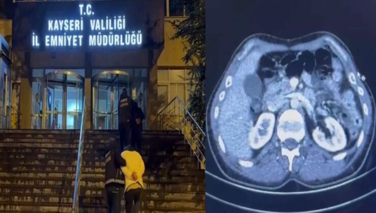 İranlı şüphelilerin midelerinden uyuşturucu çıktı