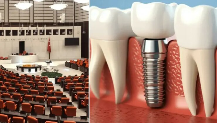 Milyonları ilgilendiren teklif Meclis’e sunuldu: İmplant tedavisini SSK karşılayacak