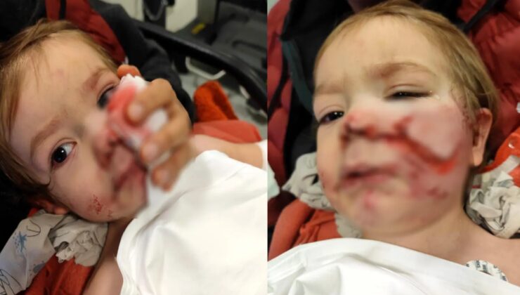 Pitbull saldırısına uğrayan minik Efe'den haber var!