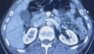 Üç İranlı röntgene girince yakayı ele verdi