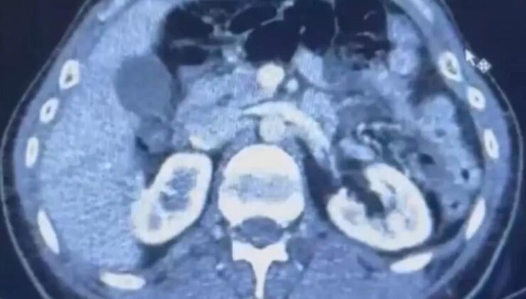 Üç İranlı röntgene girince yakayı ele verdi