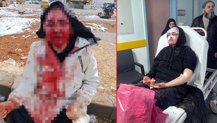 Boşanmak isteyen eşini kaldırım taşıyla bu hale getirdig