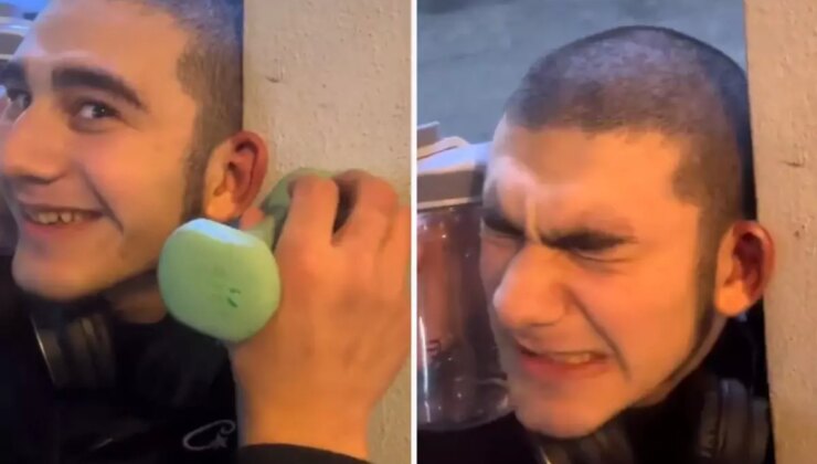 Dövüşçülere benzemek için kulak kıkırdaklarını kırdırdı