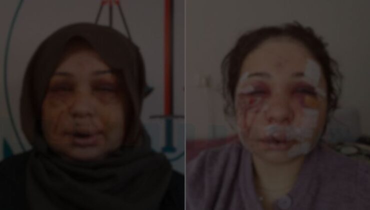 Eşini hastanelik eden polis, ifade verip serbest kaldı