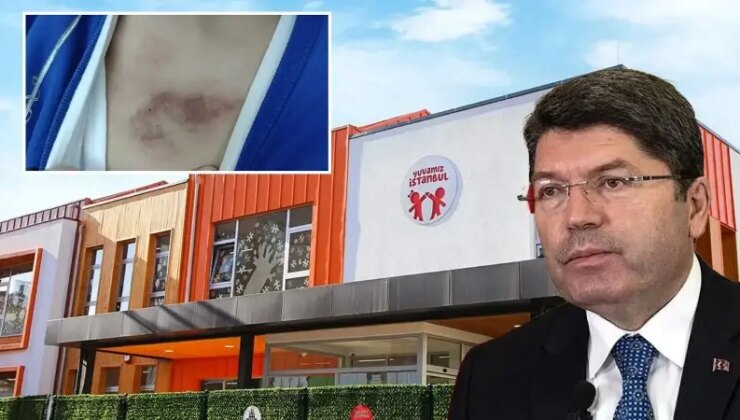 Eyüpsultan’daki İBB kreşinde darp iddiası: Bir tutuklama üç adli kontrol