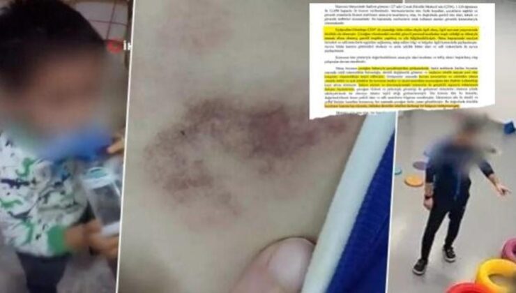 İBB’den medyaya baskı babaya itham! Kreşteki rezaleti mağdur aileye yıktılar