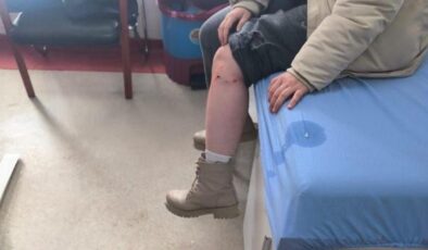 Kız çocuğuna sokak köpeği saldırısı! Zabıta amirine soruşturma açıldı