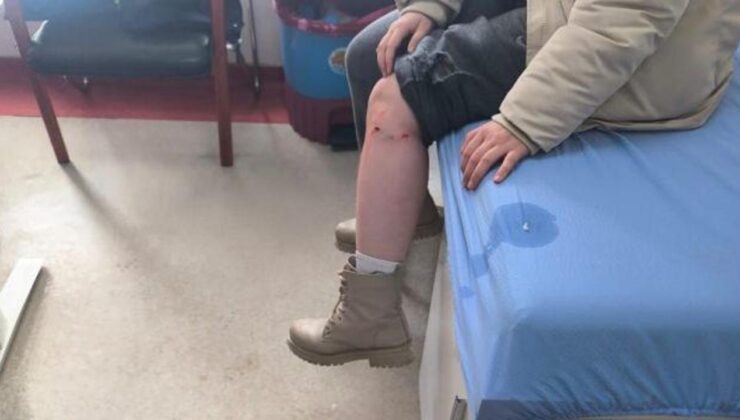 Kız çocuğuna sokak köpeği saldırısı! Zabıta amirine soruşturma açıldı