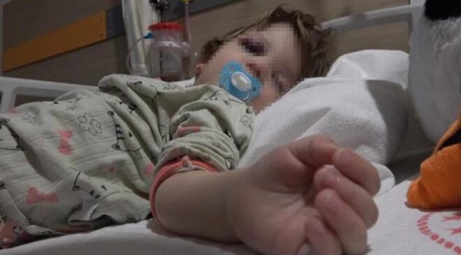 14 aylık bebeğin kafatası çatlamıştı İçişleri Bakanlığı’ndan açıklama!