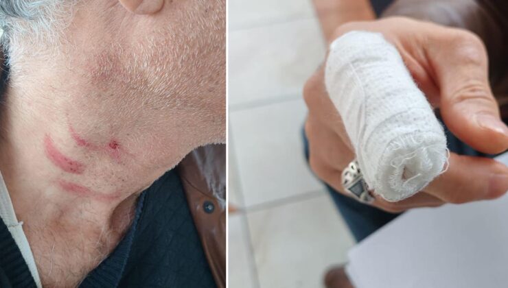 Aile hekimini döven müezzin tutuklandı