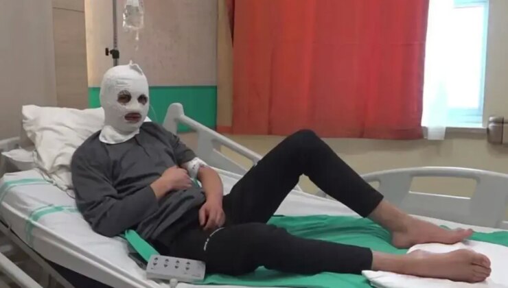 Çakmak gazı faciası! Bomba gibi patladı: Ben yandım, başkası yanmasın