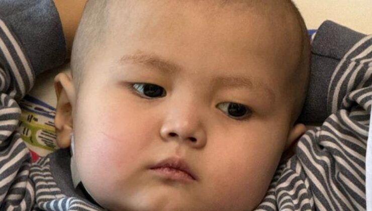 3 yaşındaki Nuryiğit, karaciğer nakliyle hayata tutundu