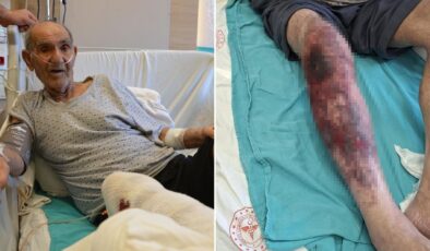 Herkesin başına gelebilir! Tıkalı lavaboyu açmak isterken yandı