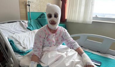 İftar hazırlığında facia: Düdüklü tencere yüzüne patladı!