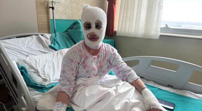 İftar hazırlığında facia: Düdüklü tencere yüzüne patladı!