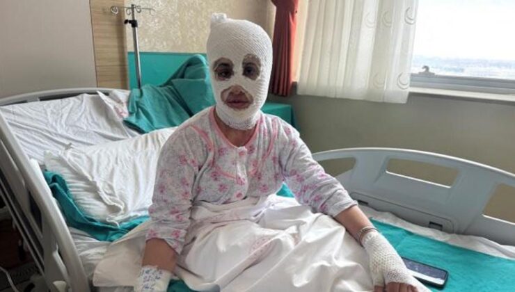 İftar hazırlığında facia: Düdüklü tencere yüzüne patladı!