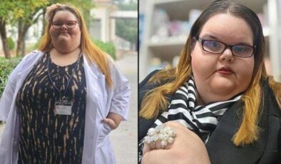 Kilosu nedeniyle akran zorbalığı gördü, 50 kilo verdi!