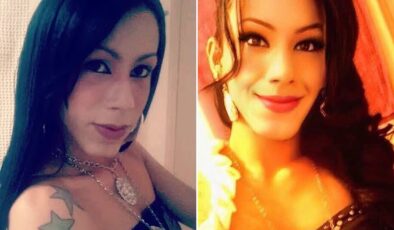 Güzellik uğruna yüzü tanınmaz hale geldi! Yine akıllanmadı