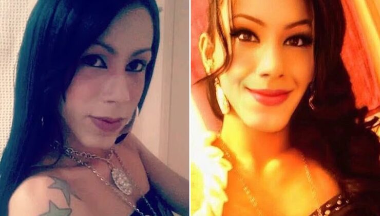 Güzellik uğruna yüzü tanınmaz hale geldi! Yine akıllanmadı