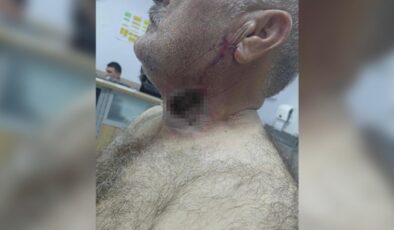 Yere düşürdü, üstünde tepindi: At, sahibini boğazından ısırdı!