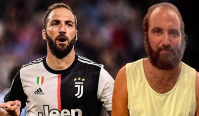 Gonzalo Higuain resmen çöktü! Son hali çok şaşırttı