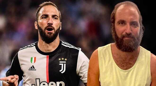 Gonzalo Higuain resmen çöktü! Son hali çok şaşırttı