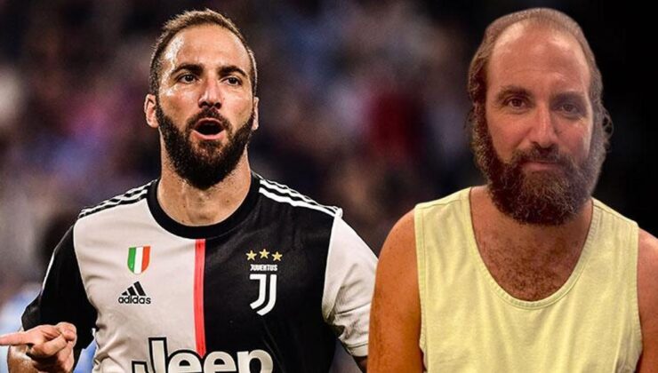 Gonzalo Higuain resmen çöktü! Son hali çok şaşırttı